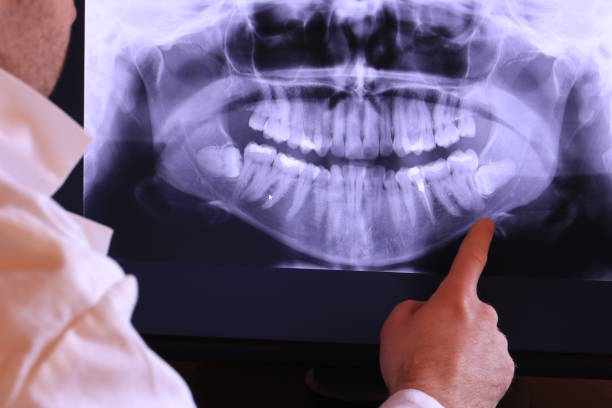 Best Emergency TMJ Treatment in Ball Ground, GA